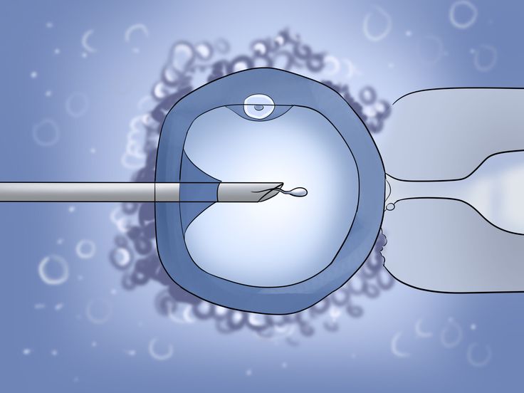 IVF Center in Jaipur